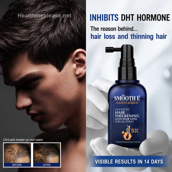 Smooth E Gentlemen Anti Hair Loss Serum Spray for Hair Thickening