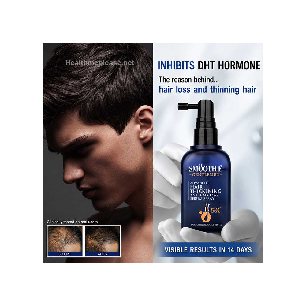 Smooth E Gentlemen Anti Hair Loss Serum Spray for Hair Thickening
